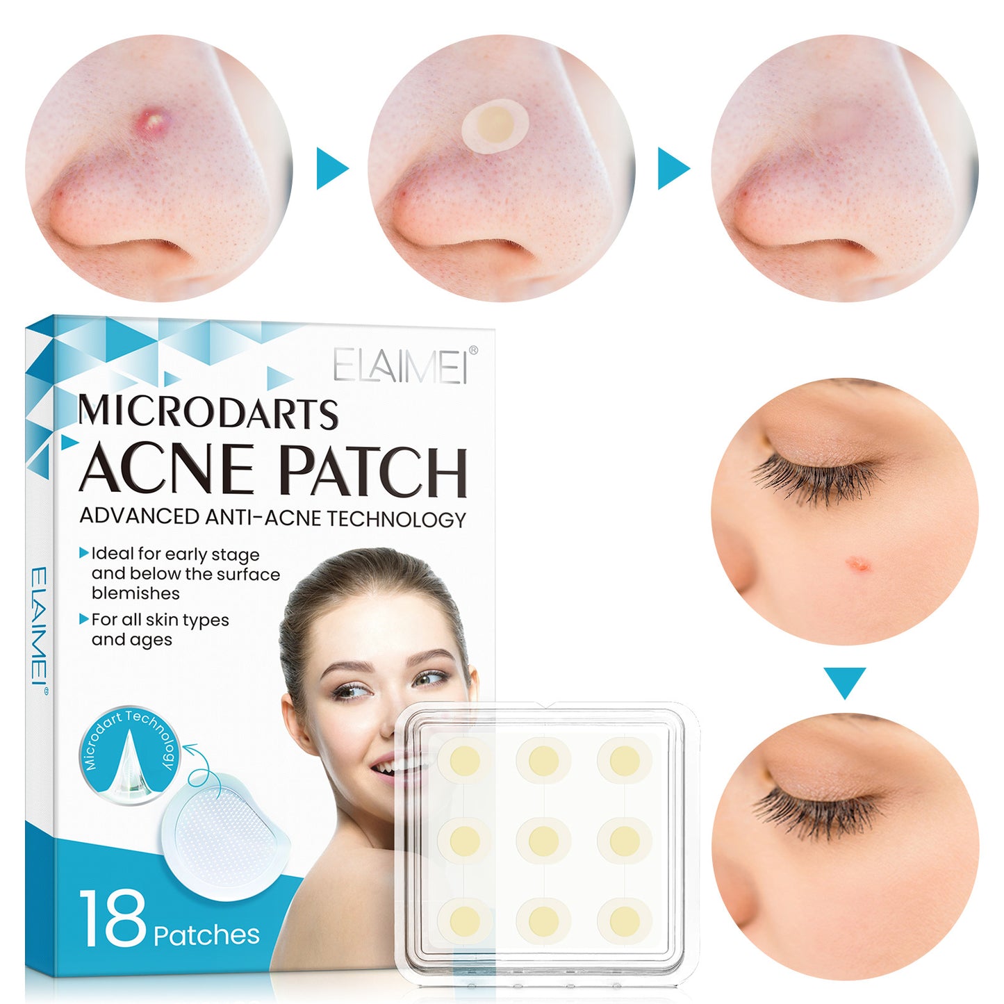 Hydrocolloid Acne Patch