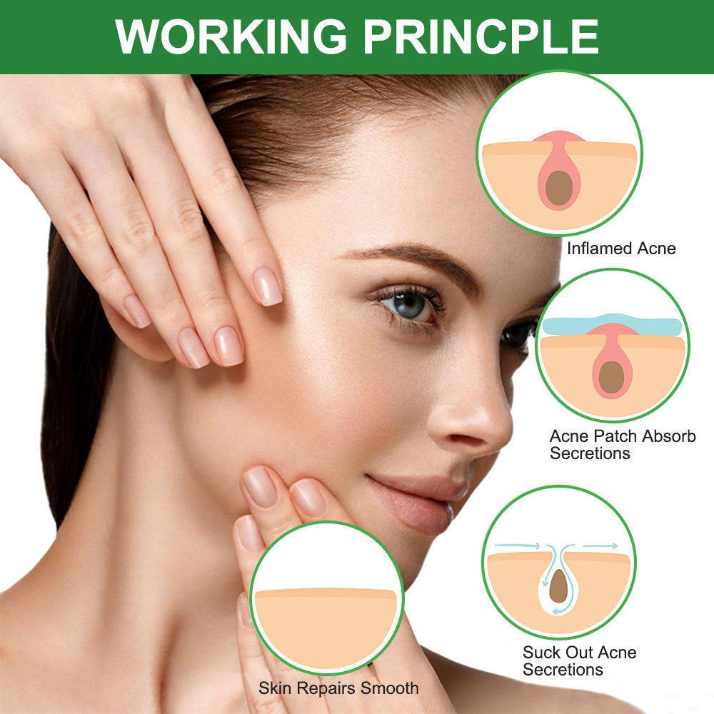 Acne Pimple Patch